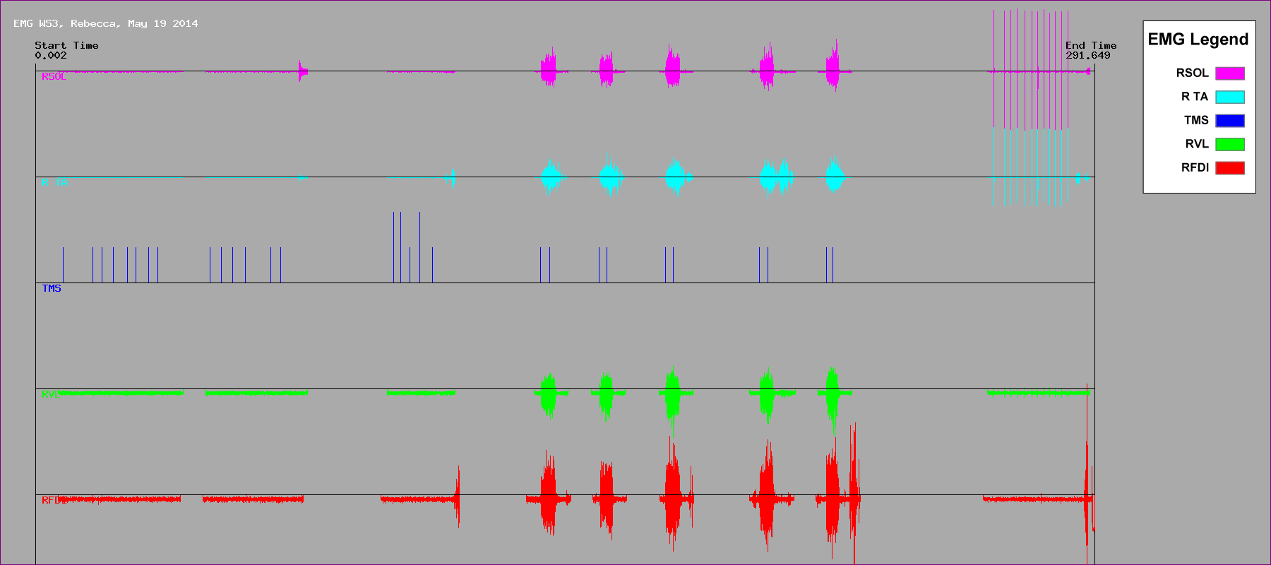 WS1